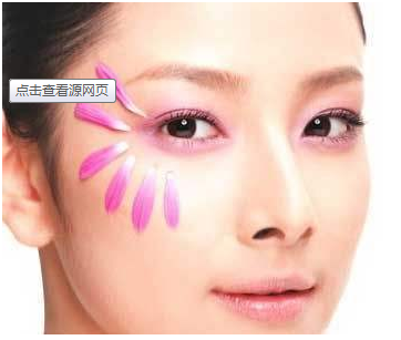 别让上睑下垂影响了你的精神百倍