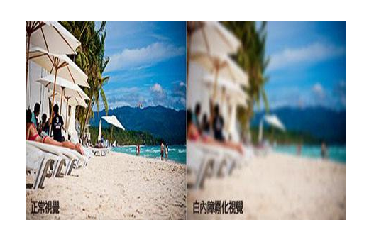 白内障小疗法