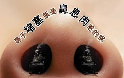 鼻息肉手术治疗的好处