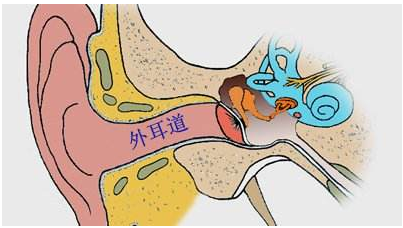 外耳道炎的预防