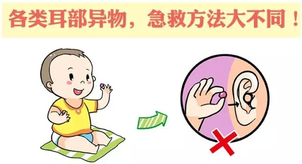 眉山眼耳鼻咽喉专科医院，外耳道异物，外耳道炎，耳鸣，中耳炎.png
