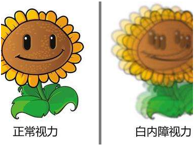 白内障，失明，眼底病，青光眼，眉山眼耳鼻咽喉专科医院.png