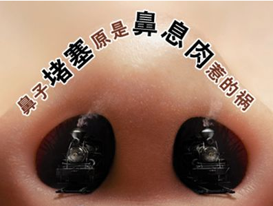 鼻息肉，水肿，蛙鼻，炎症性病变，眉山眼耳鼻咽喉专科医院.png