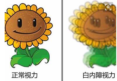 白内障饮食注意事项，白内障，白内障要趁早治疗，老年白内障，.jpg