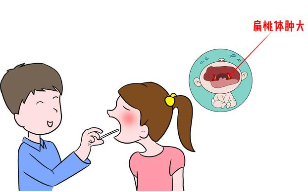 扁桃体炎，鼻塞，中耳炎，腺样体肥大，打鼾.png
