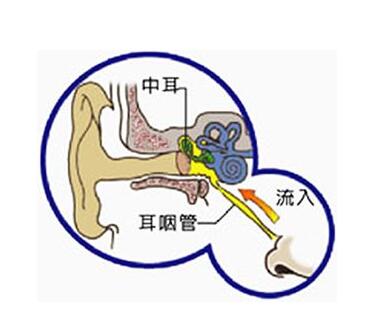 引起小儿中耳炎的原因