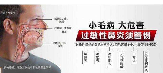 过敏性鼻炎，鼻子，鼻科，眉山哪里看鼻子好，眉山鼻科医院.jpg